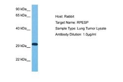 RPESP Rabbit anti-Human, Polyclonal, Novus Biologicals 0.1 mL | Buy Online | Novus Biologicals | Fisher Scientific